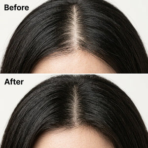 Aura™ Scalp Revival Bar