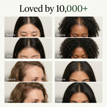Aura™ Scalp Revival Bar